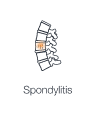 Illustration of spine highlighting inflamed joints and ligaments showing spondylitis.