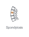 Illustration of spine highlighting inflamed disc and joints showing spondylosis.