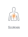 Illustration highlighting the abnormal spine curvature, indicating postural imbalances showing scoliosis.