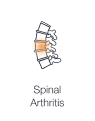 A simplified illustration of the human spine highlighting vertebral joints with inflammation leading to spinal arthritis.