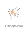 A basic illustration depicting weakened and porous bones, prone to fractures indicating osteoporosis.