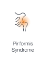 Illustration highlighting the piriformis muscle pressing on the sciatic nerve, causing hip and leg pain showing Piriformis Syndrome.