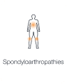 Illustration highlighting joint inflammation and spinal involvement, showing spondyloarthropathies.