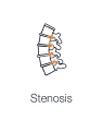 Illustration highlighting the narrowing spaces within the spine, leading to nerve compression showing spinal stenosis.