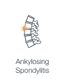 Illustration of spine highlighting inflammation caused due to fusion of the spine’s vertebrae together showing ankylosing spondylitis.