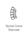 Illustration of spine depicting narrowed spinal canal showing spinal canal stenosis.