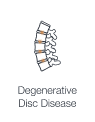 Illustration highlighting disc degeneration in the spine, indicating degenerative disc disease and associated pain.