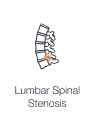 Illustration highlighting nerve compression in the lumbar spinal canal.