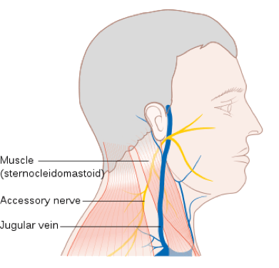 https://www.qispine.com/wp-content/uploads/2019/04/condition-headache-with-neck-pain.png
