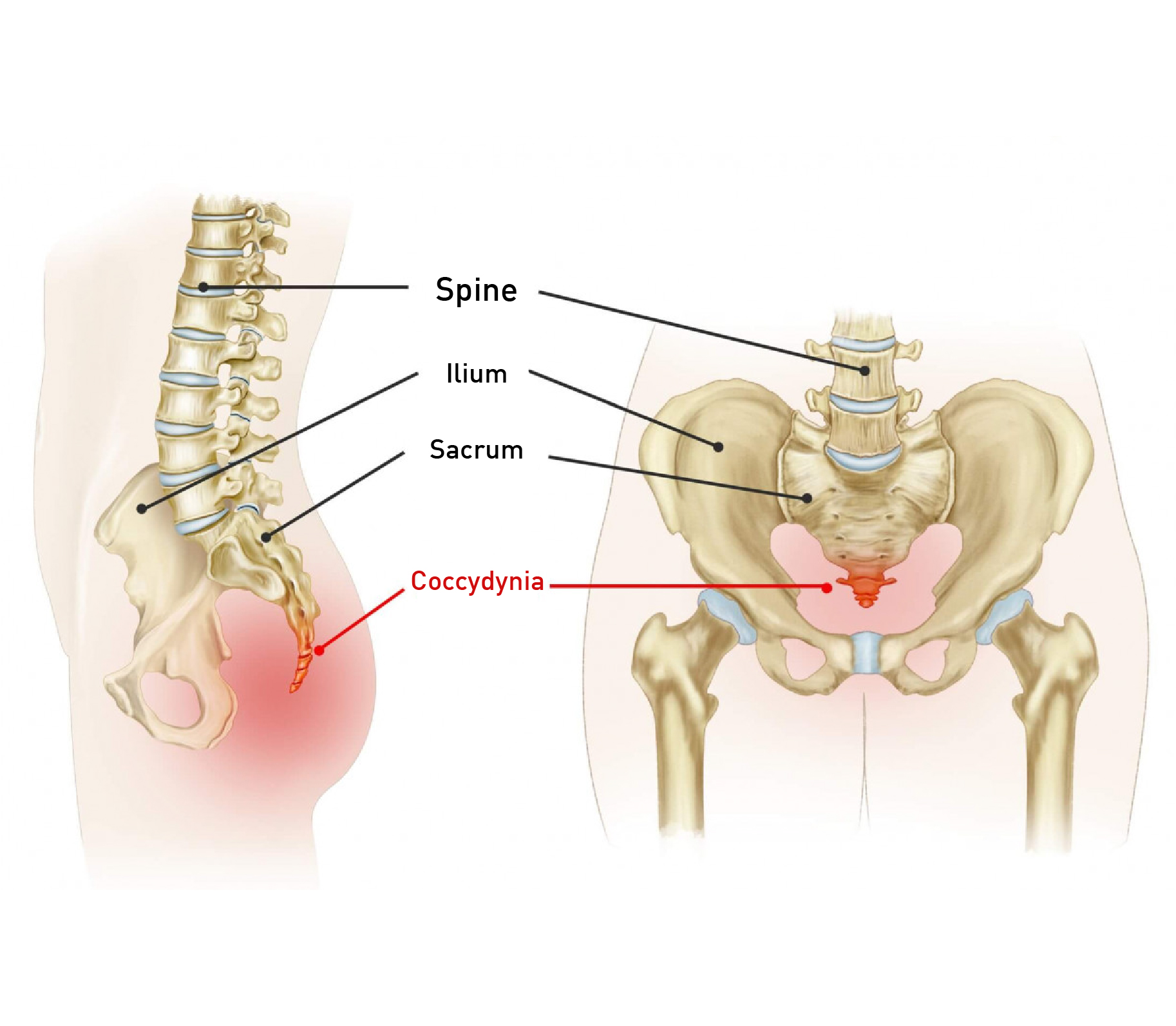 Relieve TAILBONE PAIN in SITTING  4 Physiotherapy Treatments for