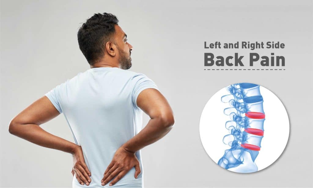 Left And Right Side Back Pain: Treatment, Causes & Diagnosis 