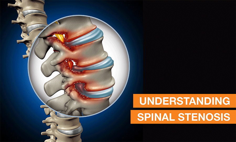 Best Spine Specialists Treatment In Mumbai Blogs QI Spine