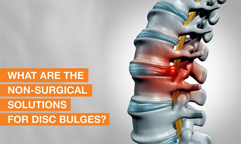Cervical spine disc bulge
