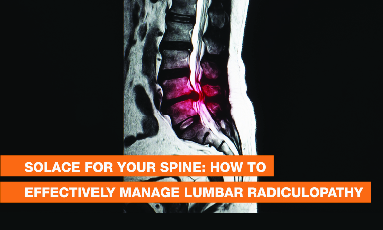 Blog Image - Solace for Your Spine: How to Effectively Manage Lumbar Radiculopathy