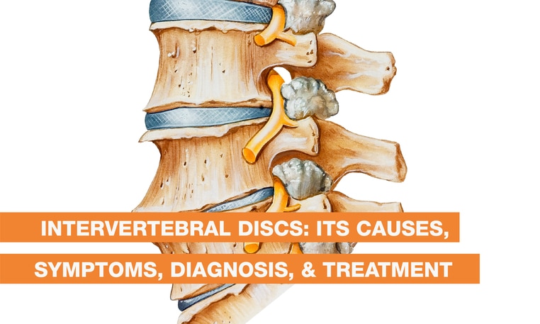 Intervertebral Discs: Its Causes, Symptoms, Diagnosis, & Treatment